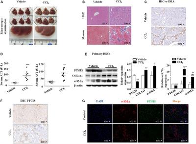 DNA Methylation of PTGIS Enhances Hepatic Stellate Cells Activation and Liver Fibrogenesis